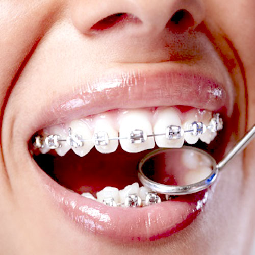 https://hd-smile.com/wp-content/uploads/2025/09/white.jpg